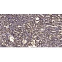 Ron α Polyclonal Antibody