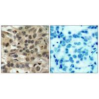 Cdc25C Polyclonal Antibody