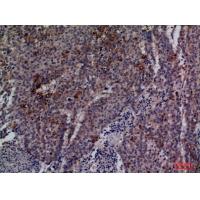 Cdc34 Polyclonal Antibody