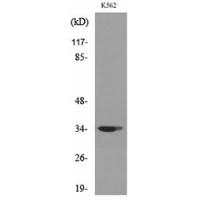 Cdc34 Polyclonal Antibody