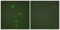 CDC46 Polyclonal Antibody