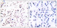 CDC46 Polyclonal Antibody