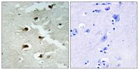 CdcA4 Polyclonal Antibody