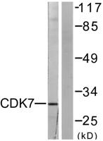 Cdk7 Polyclonal Antibody
