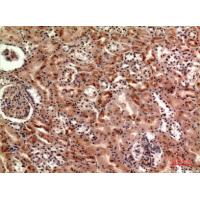 Cerberus Polyclonal Antibody