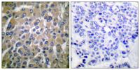 Choriogonadotropin β Polyclonal Antibody