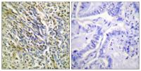 Cleaved-Aggrecan (D369) Polyclonal Antibody