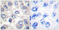 Cleaved-Bad (D71) Polyclonal Antibody