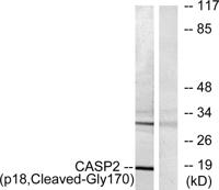 Cleaved-Caspase-2 p18 (G170) Polyclonal Antibody