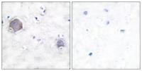 Cleaved-Notch 1 (V1754) Polyclonal Antibody