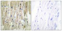 CLP36 Polyclonal Antibody