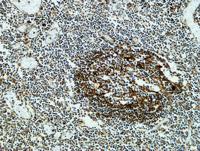Clusterin Polyclonal Antibody