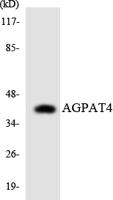 LPAAT-δ Polyclonal Antibody