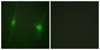 LKB1 Polyclonal Antibody