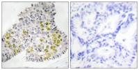 LKB1 Polyclonal Antibody
