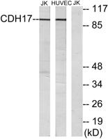 LI-cadherin Polyclonal Antibody