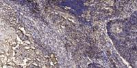 LDLRAD2 Polyclonal Antibody