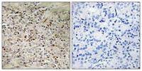UROC28 Polyclonal Antibody