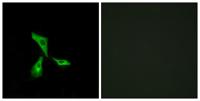 GPR101 Polyclonal Antibody