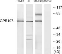 GPR107 Polyclonal Antibody