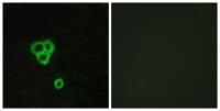 GPR119 Polyclonal Antibody