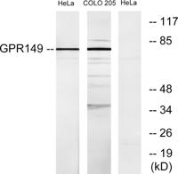 GPR149 Polyclonal Antibody