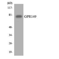 GPR149 Polyclonal Antibody