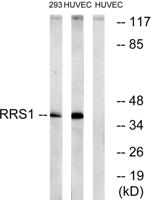RRS1 Polyclonal Antibody