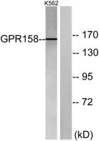 GPR158 Polyclonal Antibody