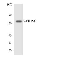 GPR158 Polyclonal Antibody