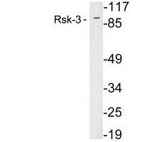 RSK3 Polyclonal Antibody