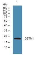 GSTM1 Polyclonal Antibody
