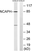 hCAP-H Polyclonal Antibody