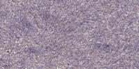 Sarcoglycan α Polyclonal Antibody