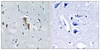 Hepatic Lipase Polyclonal Antibody
