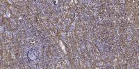 Septin 1 Polyclonal Antibody