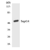 Septin 14 Polyclonal Antibody