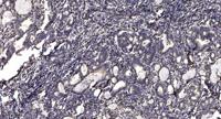 Septin 14 Polyclonal Antibody