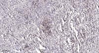 Septin 2 Polyclonal Antibody