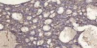 Septin 3 Polyclonal Antibody