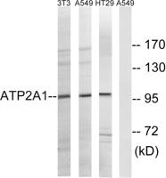 SERCA1 Polyclonal Antibody