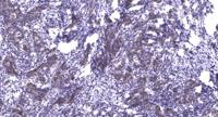 SERCA1 Polyclonal Antibody