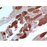 SERCA2 Polyclonal Antibody