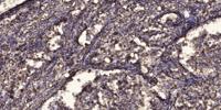SFRS11 Polyclonal Antibody