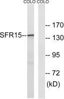 SFRS15 Polyclonal Antibody
