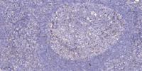 SFRS15 Polyclonal Antibody