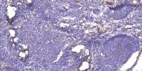 SFT2D2 Polyclonal Antibody