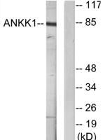 SgK288 Polyclonal Antibody