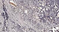 SGLT-1 Polyclonal Antibody