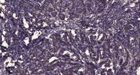 Siah-1/2 Polyclonal Antibody